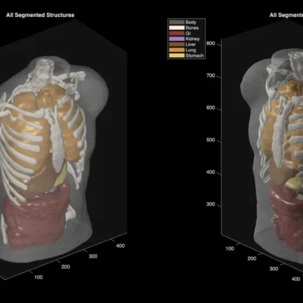 Midjourney goes from generating cat images to full-body ultrasound scans