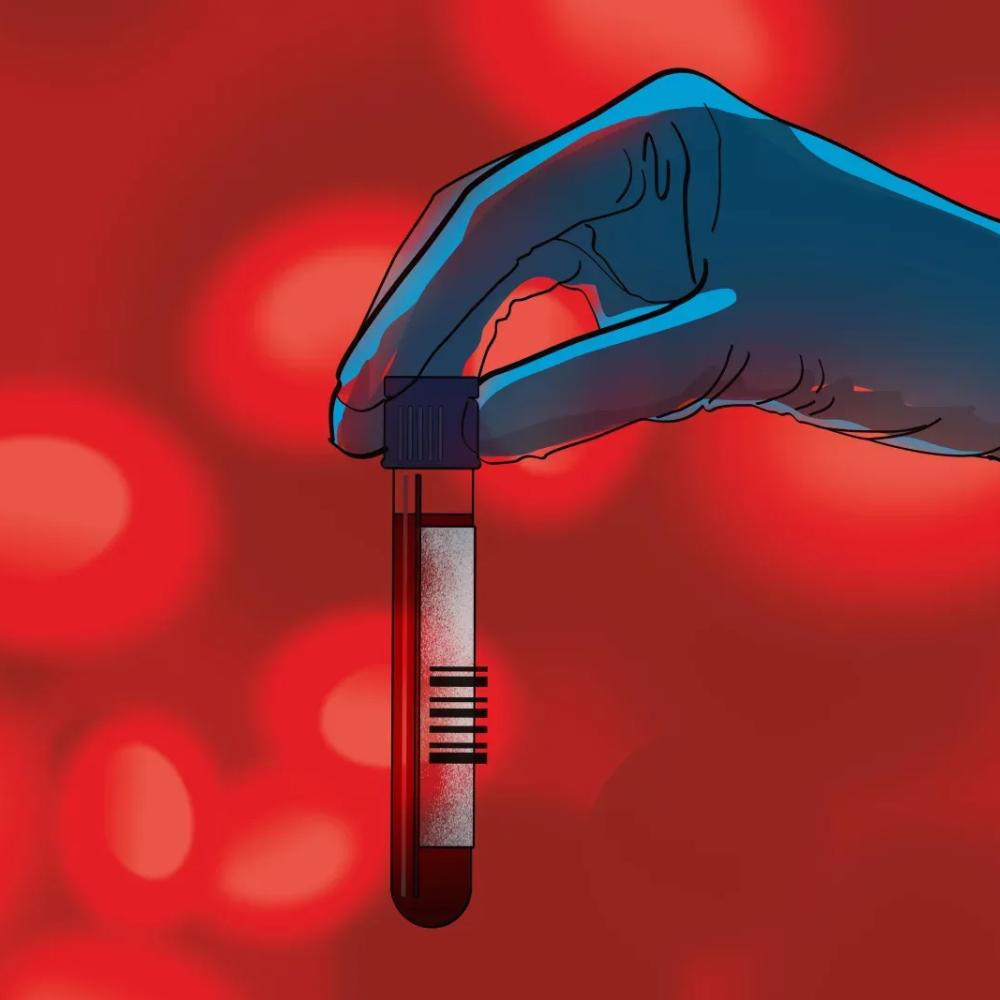 A blood test that screens for multiple types of cancer? It may be available soon