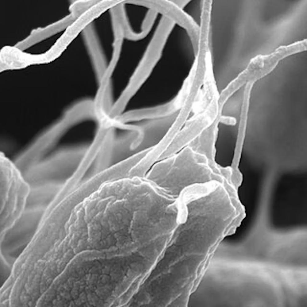 How generative AI and physics can help design new antibiotics