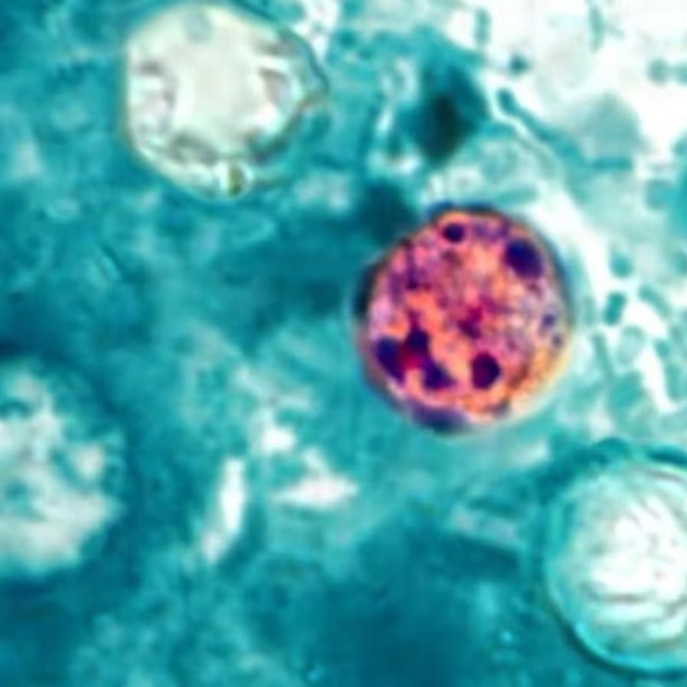 Diarrhea-causing parasite that can contaminate raw produce causing misery across several states