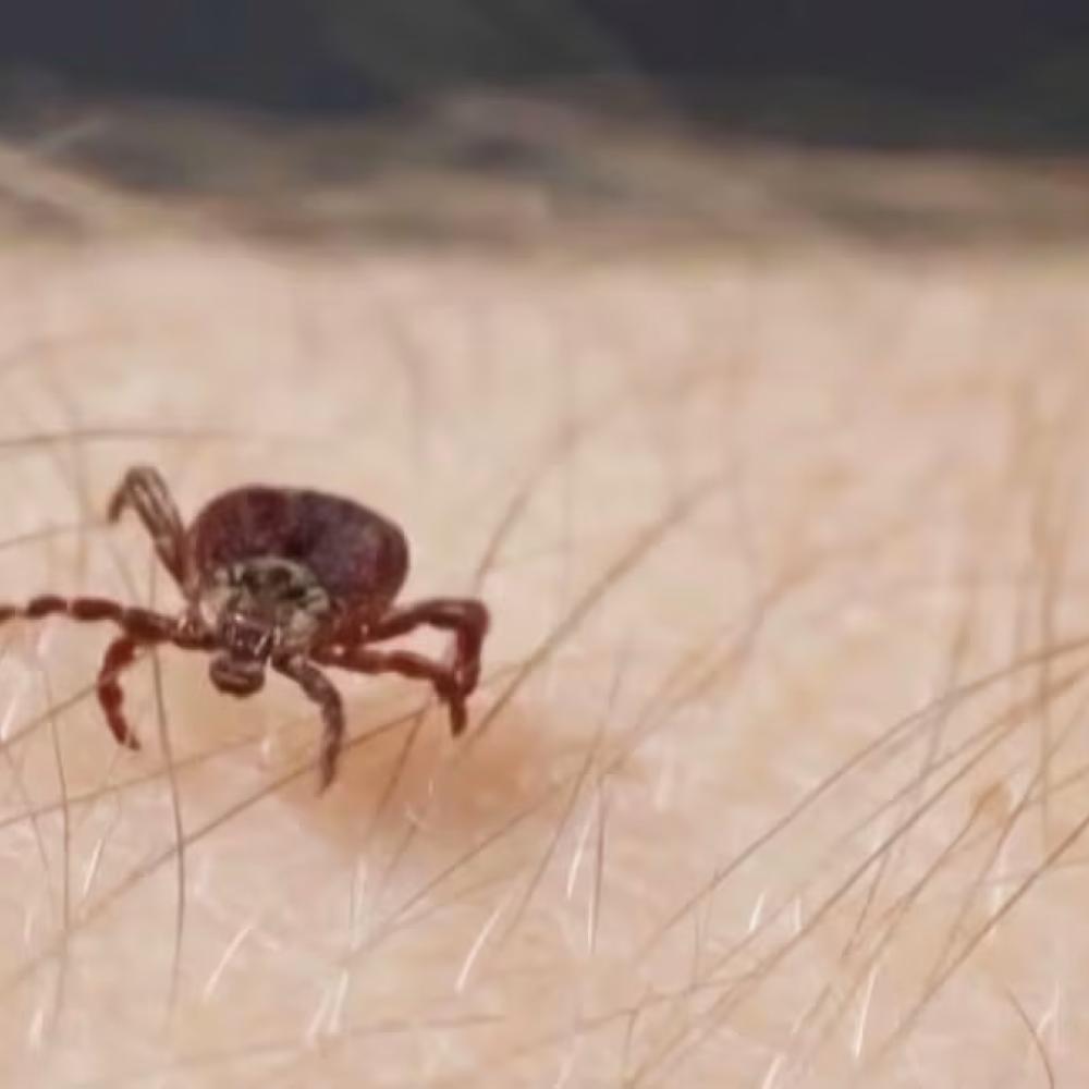 ‘My fingers were purple’: Tick-borne disease nearly killed a Canadian man
