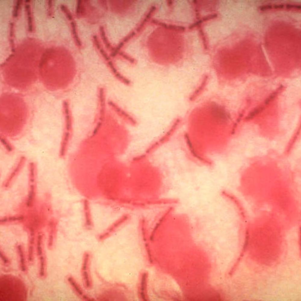 AI can fuel biological weapons. We must harness its power for defense