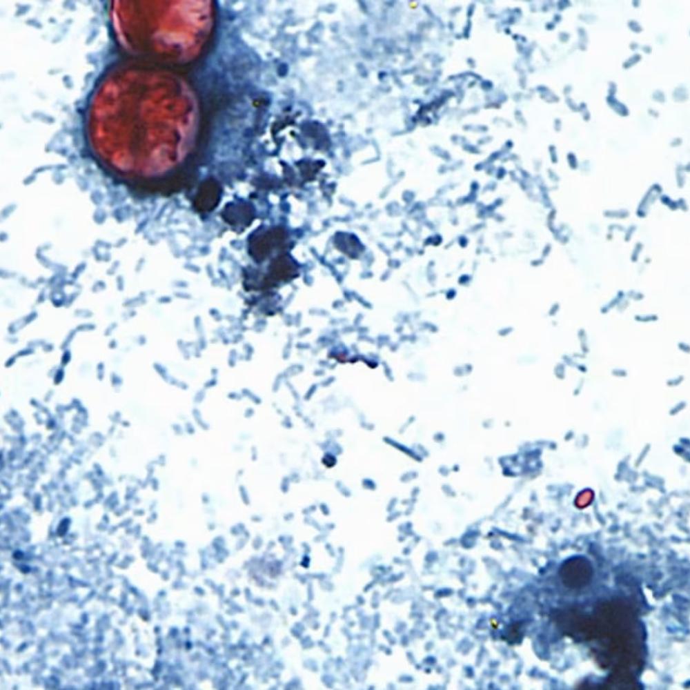 CDC expands largest known cyclospora outbreak to 15 states, Washington Post reports