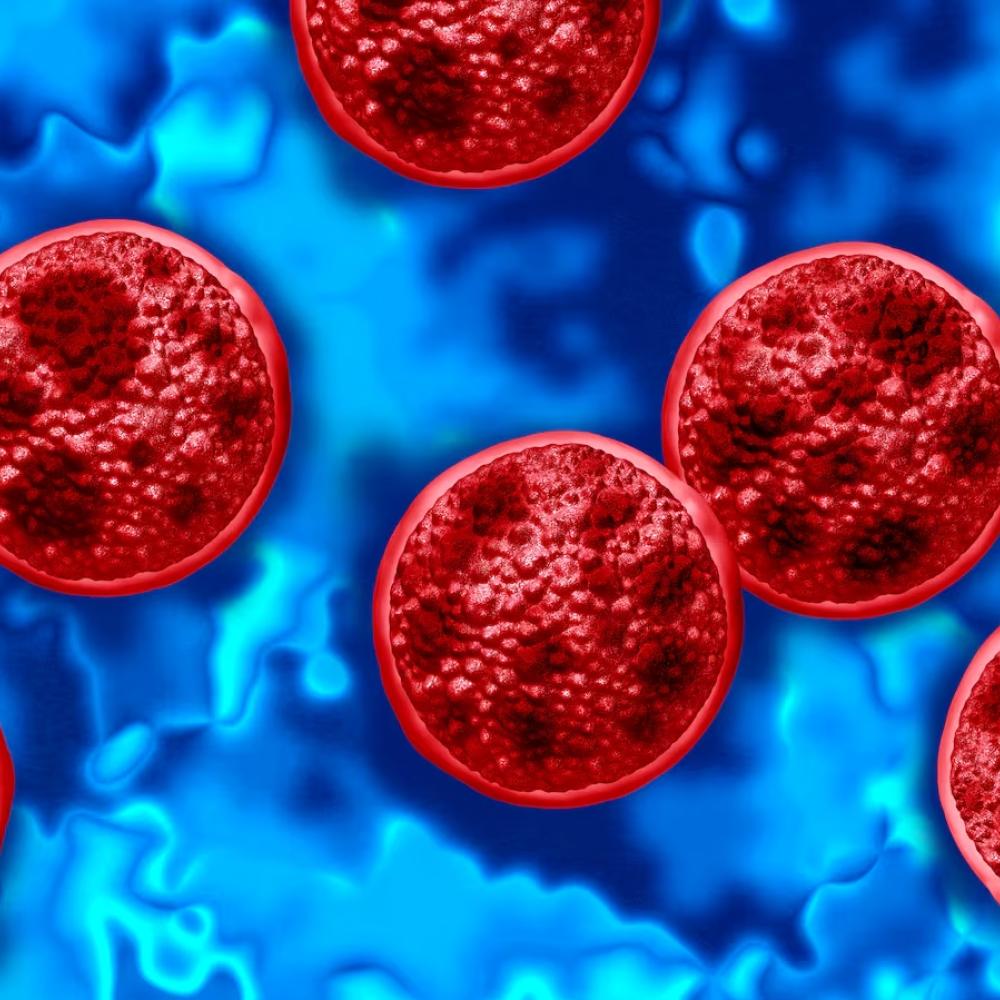 Cyclosporiasis outbreak has affected about 1 in every 1,000 people in Michigan and killed two