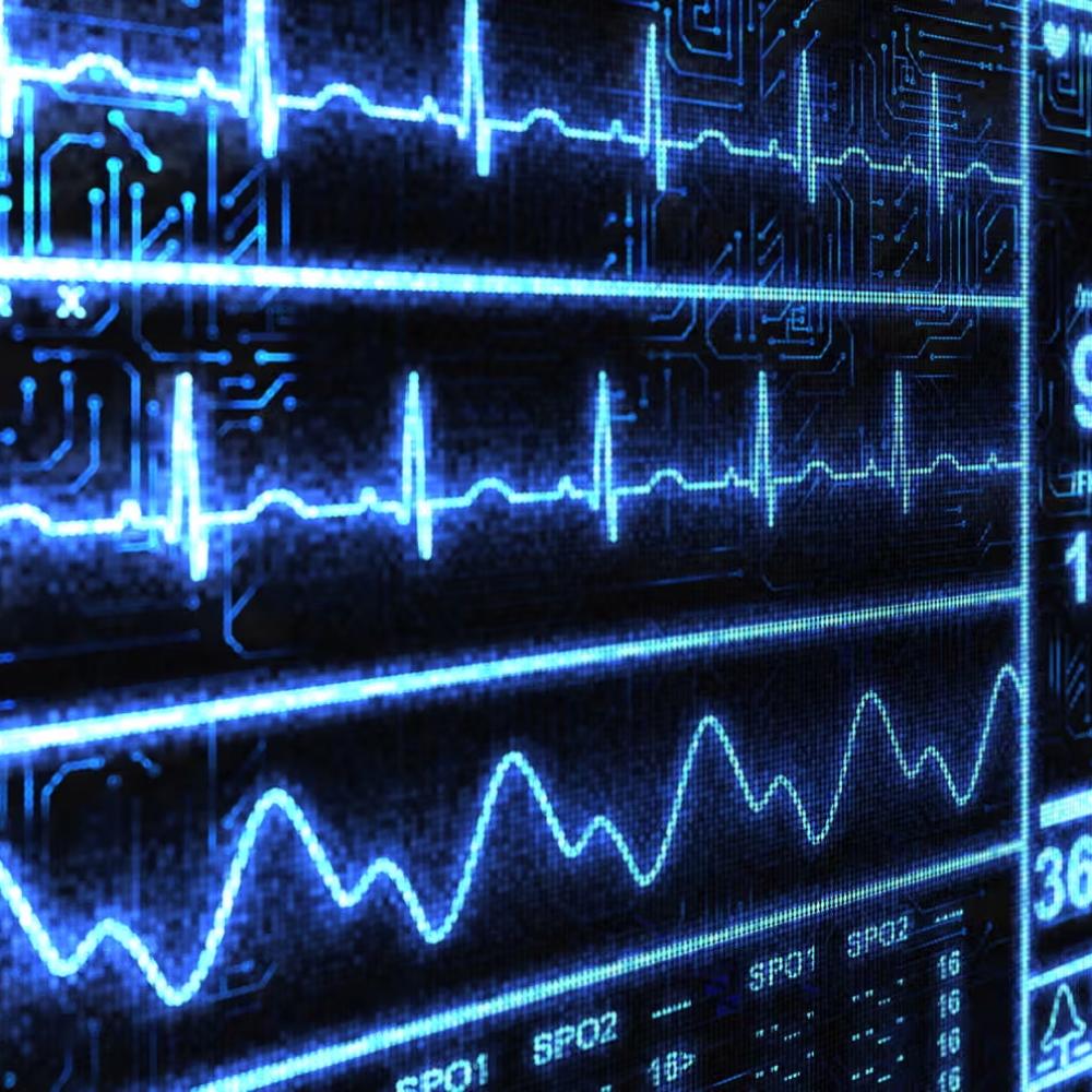‘Superhuman’ AI tool spots heart disease in less than 2 seconds