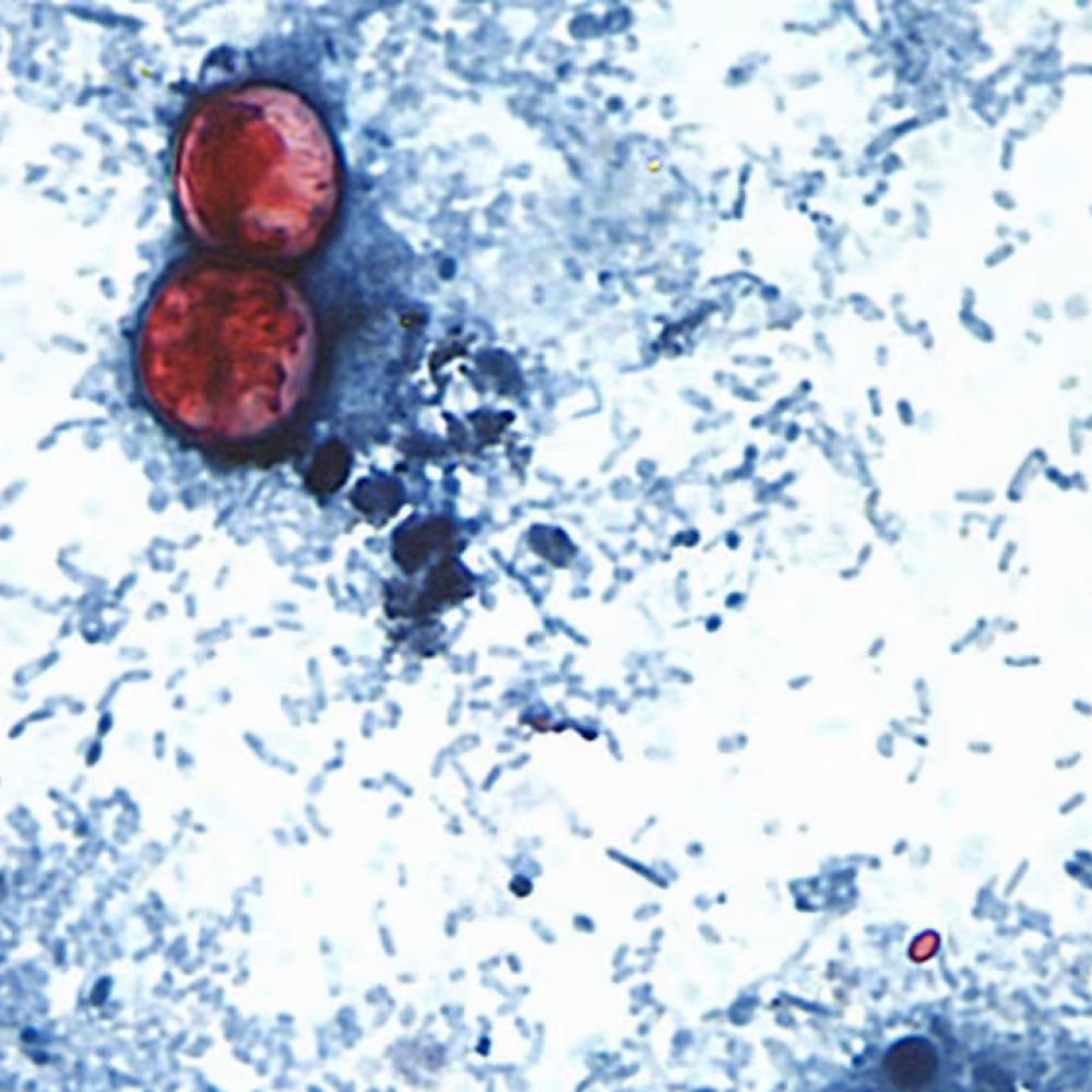 U.S. federal officials declare end to cyclospora outbreak that sickened thousands in 21 states