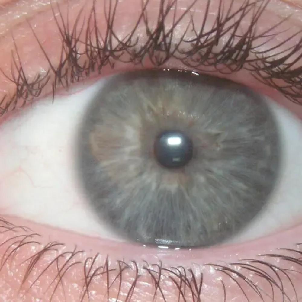 How governments can preserve trust while expanding access to vision care