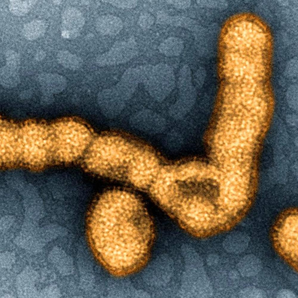 A swine flu case to keep tabs on