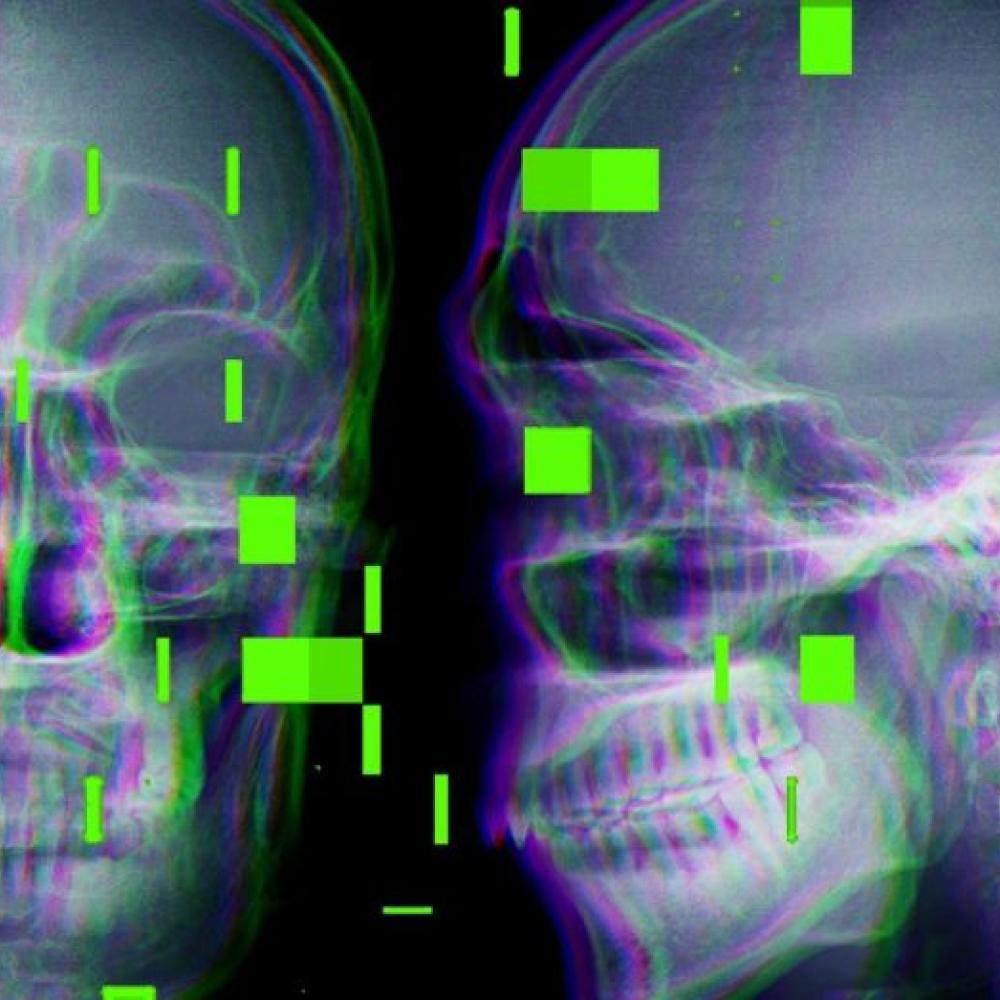 As AI enters the operating room, reports arise of botched surgeries and misidentified body parts