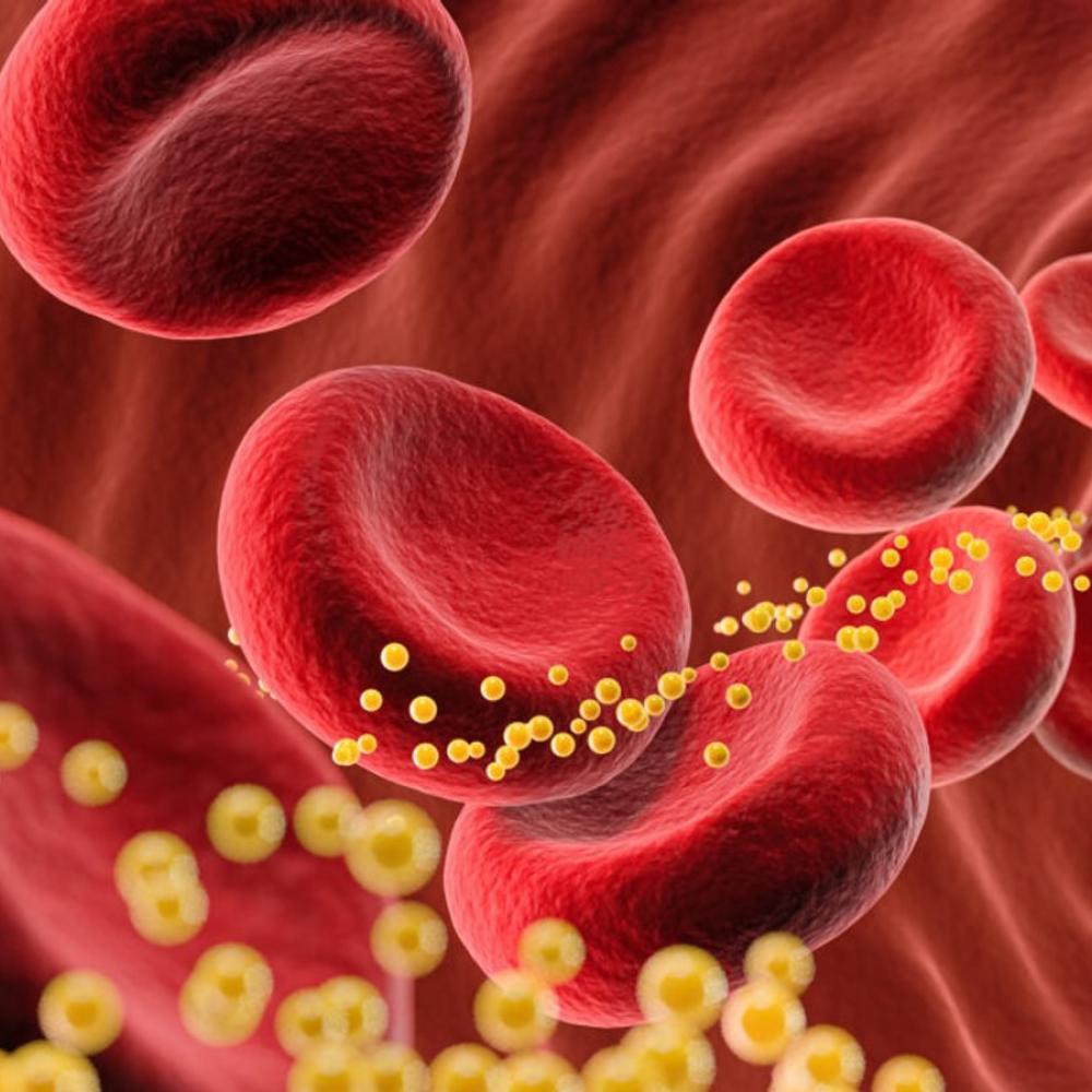 Bad cholesterol slashed 62% by single dose of gene-editing drug in small trial
