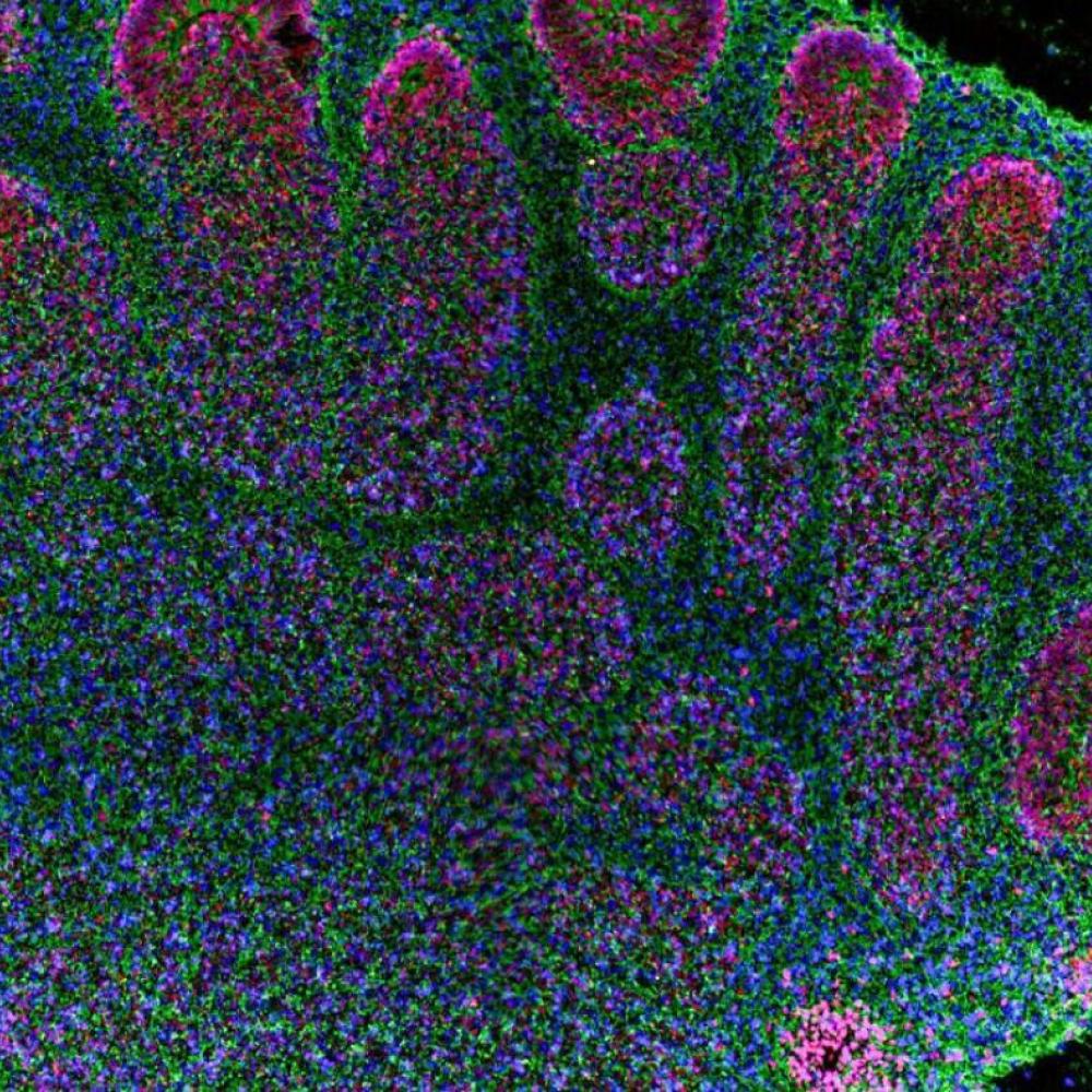 Brain organoids are helping researchers, but raise ethical questions