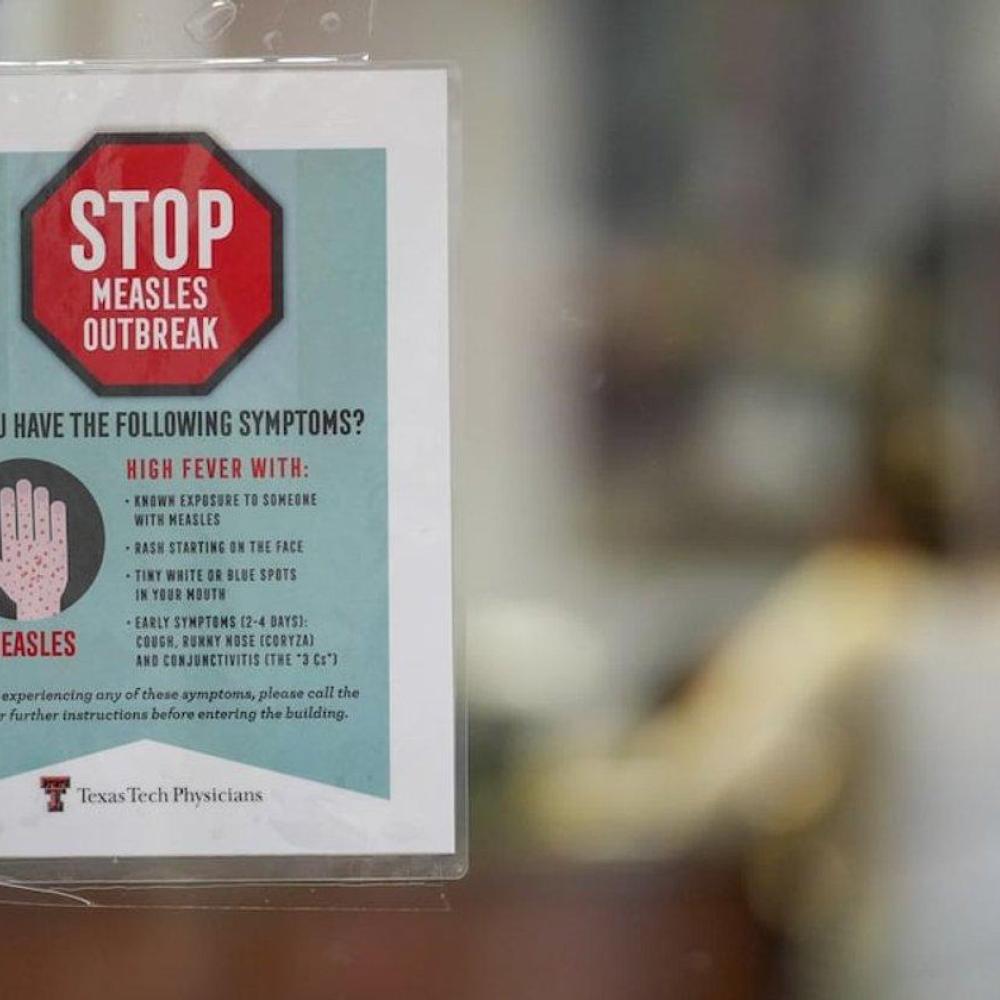Canada has half as many measles cases as U.S.: WHO data