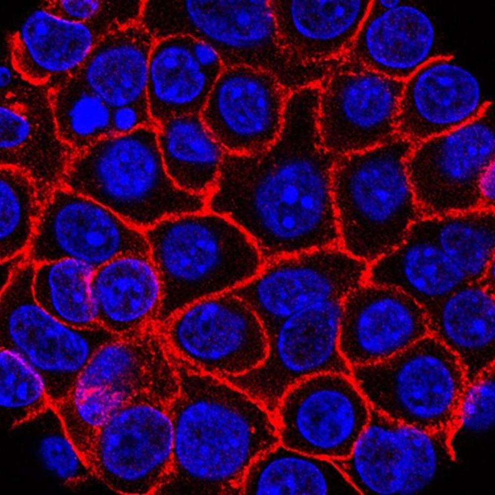 Experimental pill promises new hope for deadly pancreatic cancer