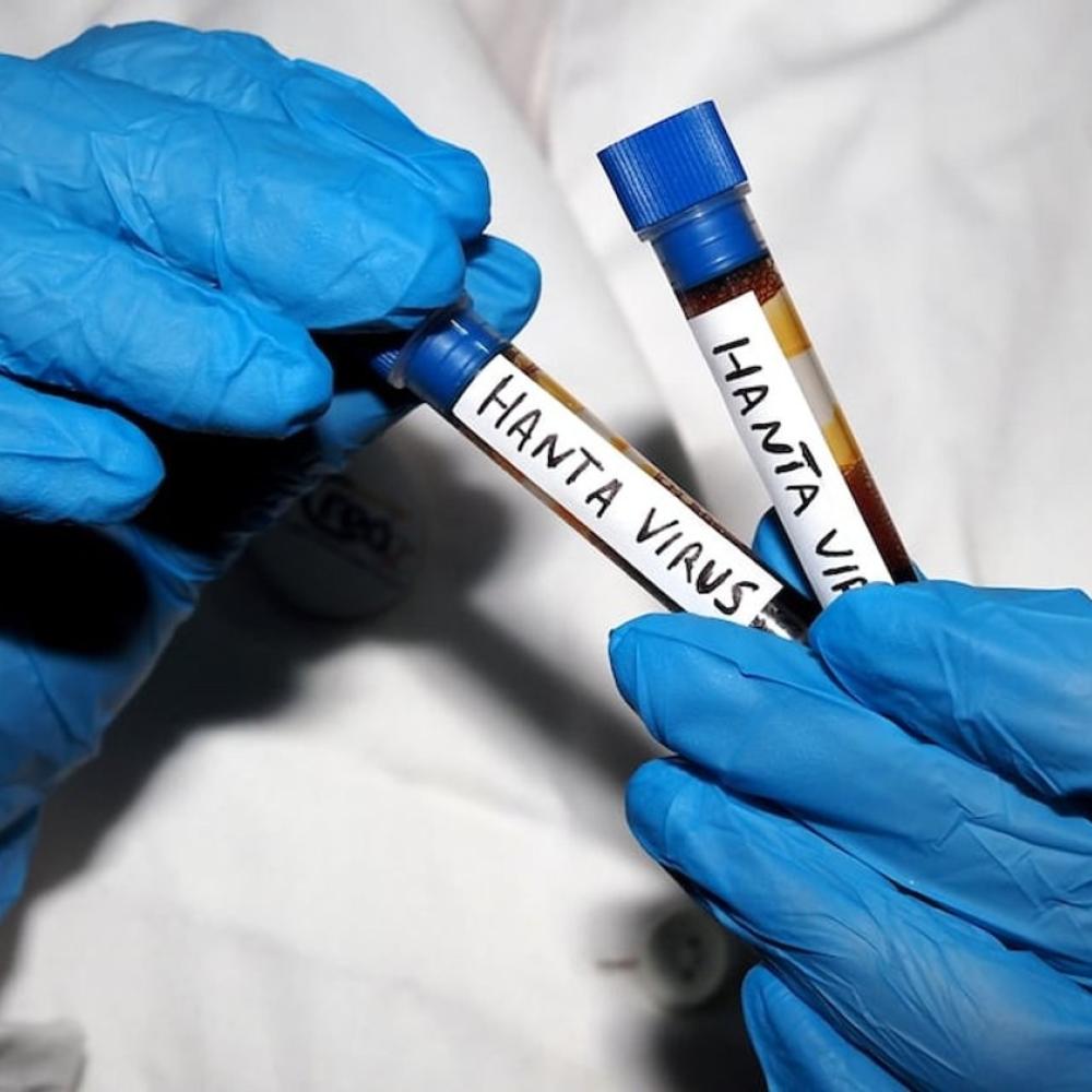 Hantavirus outbreak could be over 'sooner rather than later': Infectious diseases specialist