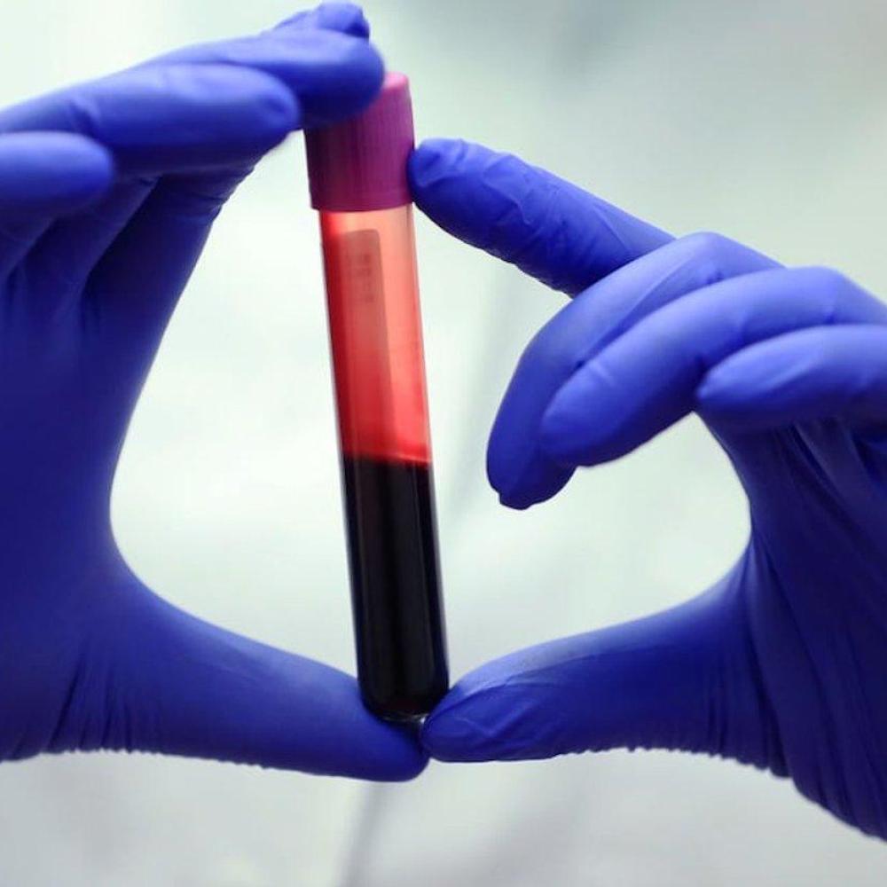 Made-in-B.C. test determines which parent passed on gene linked to increased cancer risk