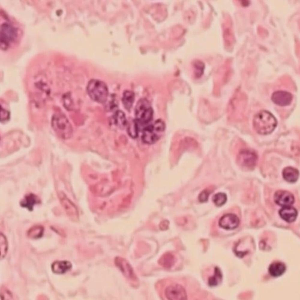 Measles exposure at Winnipeg Jets game, province warns large events may pose risk for months