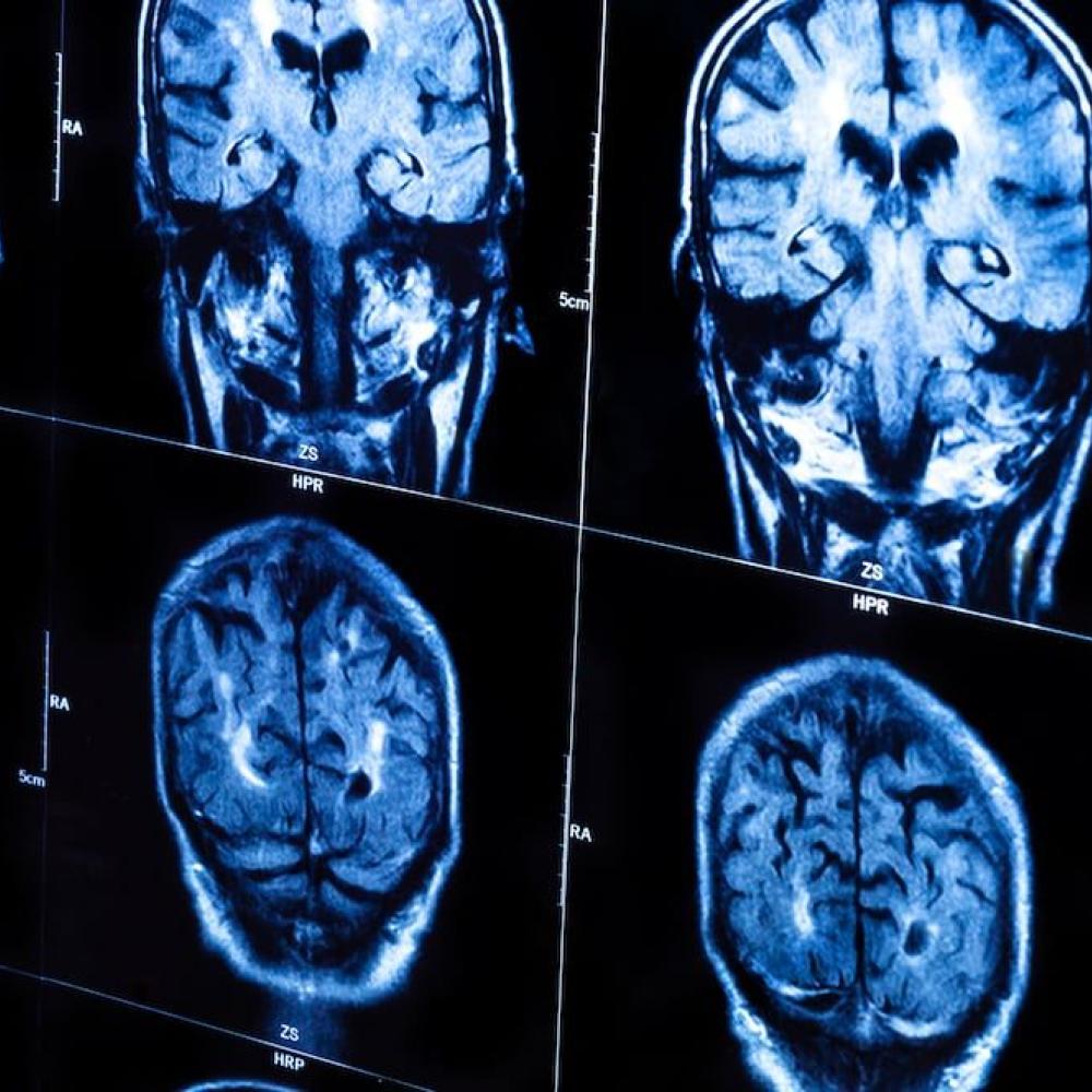 Mobile brain scans sound like science fiction. But they're now helping more Canadian patients