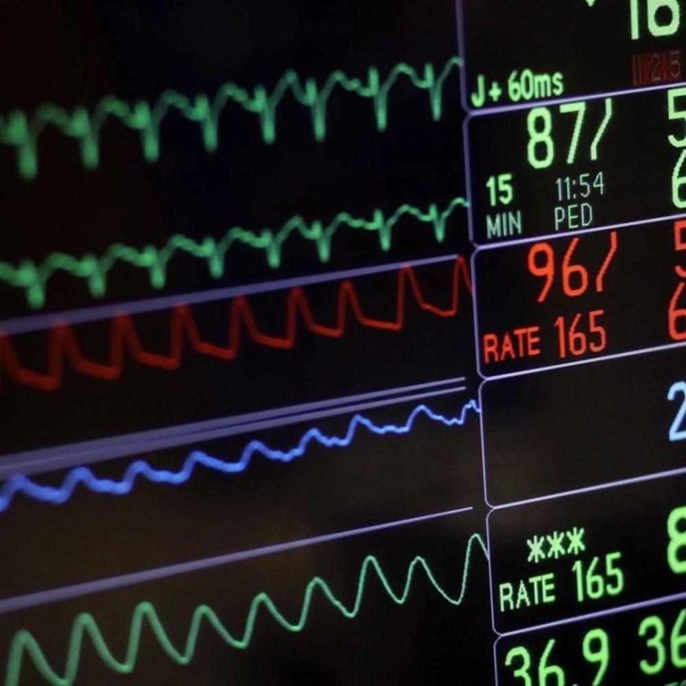 Parliamentary panel studying MAID mental health expansion is biased: expert