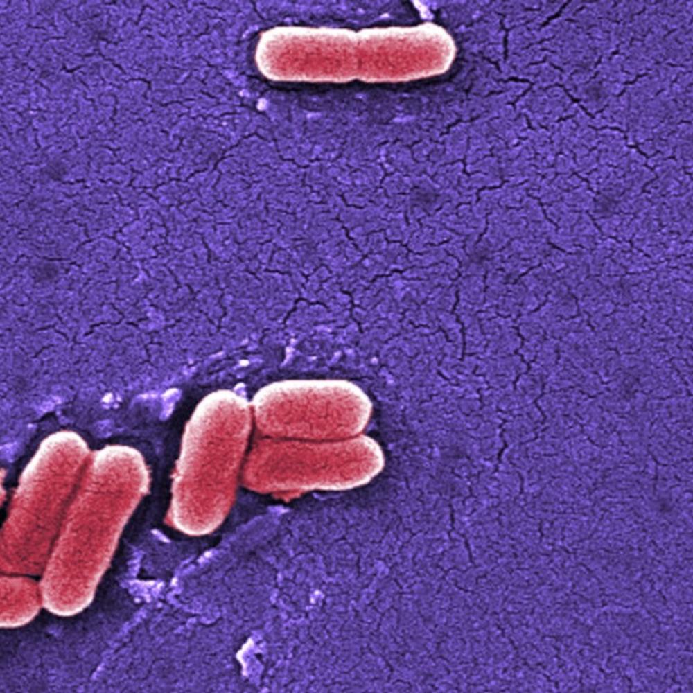 Raw dairy co. refutes connection to E. coli outbreak