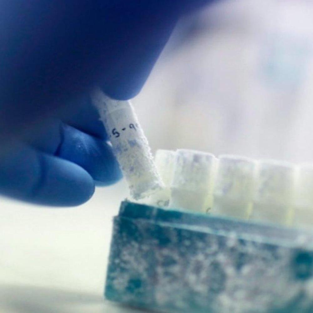 Sperm cells are at their highest quality during summer, study finds