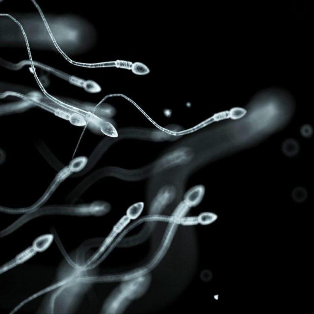 Sperm donor with rare cancer mutation fathered nearly 200 children in Europe