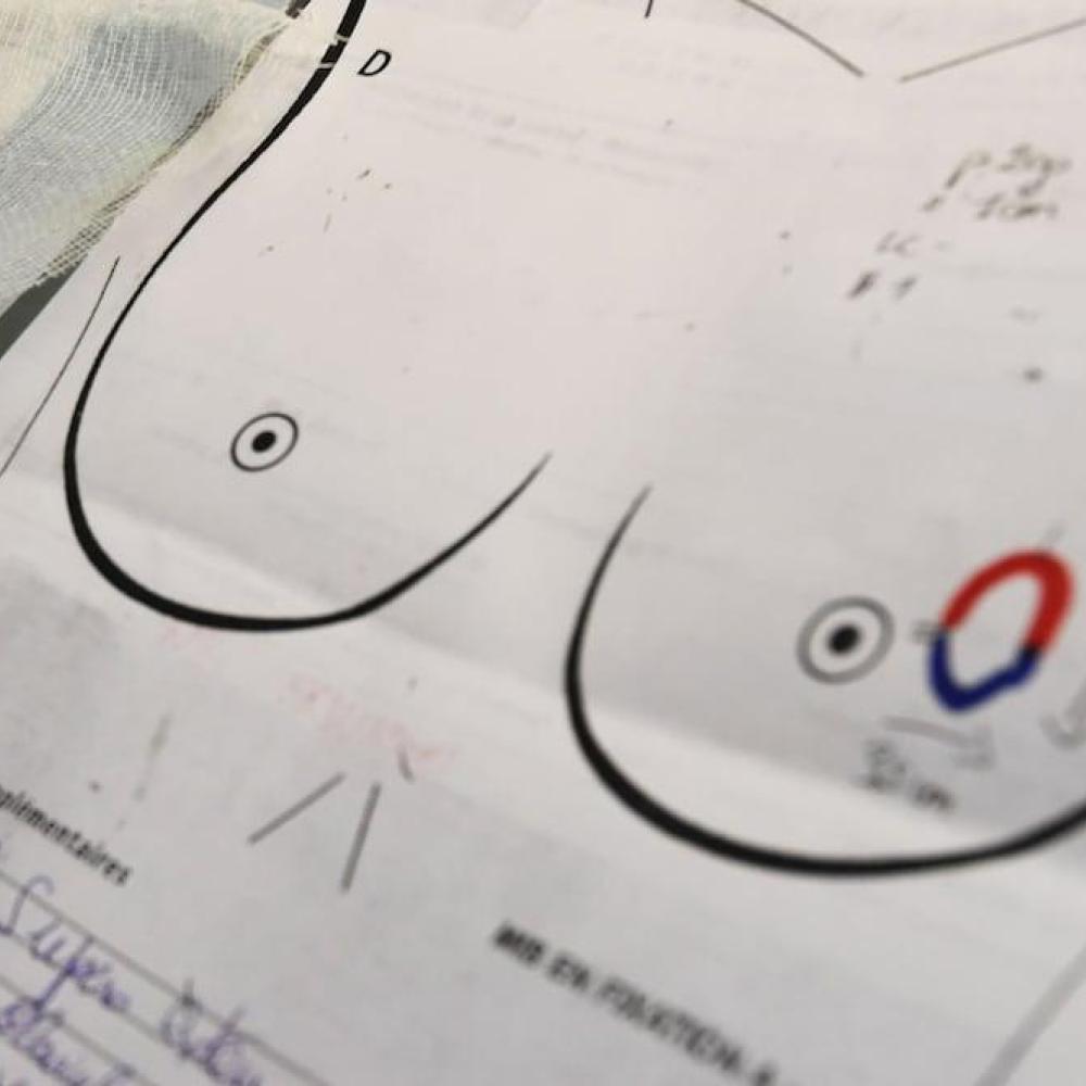 Why do pregnancy, breastfeeding reduce risk of breast cancer? Latest science finds clues