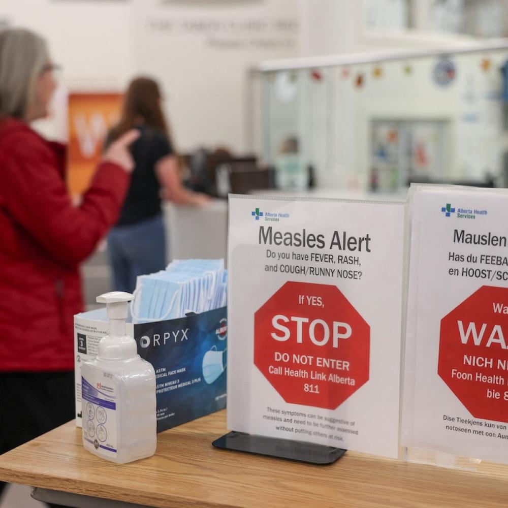 With a third of Ontario’s population, Alberta has the most measles cases, after the province withheld hundreds of probable cases from public reporting