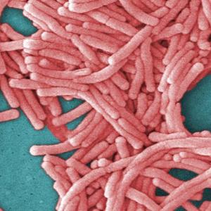 1 dead, more than 40 sick as legionnaires' outbreak spreads in southeast London