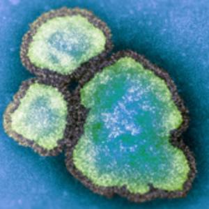 U of Sask. researcher reports decline in public trust of health experts