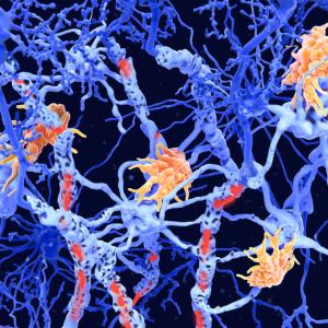 ‘Inverse vaccines’: the promise of a ‘holy grail’ treatment for autoimmune diseases