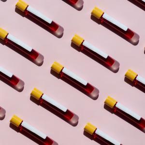 Is in-depth and expensive blood work worth it?