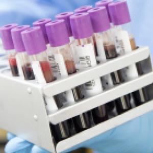 Your Blood Predicts Alzheimer's Disease