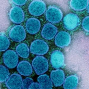 WHO adds NB.1.8.1 as SARS-CoV-2 variant under monitoring