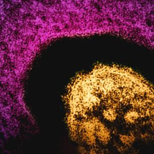 Measles cases are surging globally. Should children be vaccinated earlier?