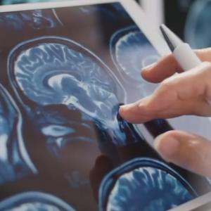 B.C. privacy watchdog weighs in on health AI boom