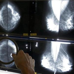 Health screening task force to relaunch next spring after report calls for reform