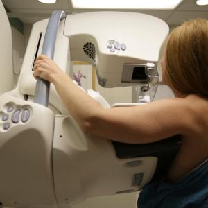 ‘This is great news’: doctors applaud move to modernize cancer screening guidelines