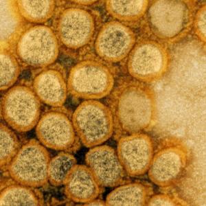 New COVID variant swiftly gains ground in US; summer wave looms
