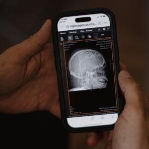 Treating Chronic Pain is Hard. An Experimental Approach Shows Promise.