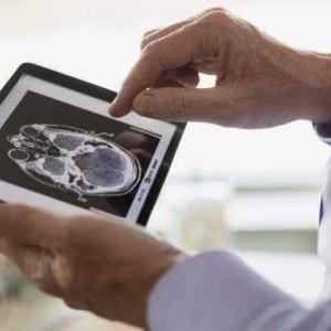Doctors concerned as Alberta moves to fast‑track medical tests without referrals