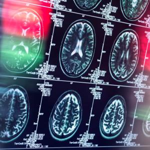 Antidepressants and antipsychotics could serve as alternatives to opioids, study finds
