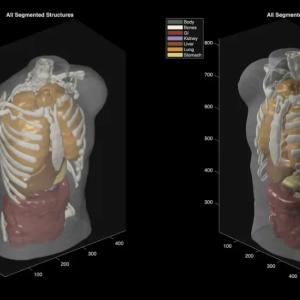 Midjourney goes from generating cat images to full-body ultrasound scans