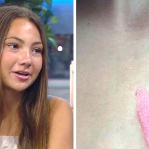 ‘The whole skin came off’: Dangerous implications from social media trend involving microwaved toys