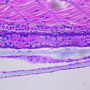 SickKids-led research uncovers new genetic cause of Crohn’s disease