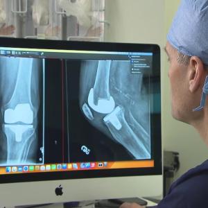Manitoba wait times for knee replacement surgery 2nd worst in country in 2025, data says