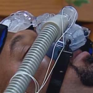 What is sleep apnea? Ottawa sleep expert discusses symptoms and treatment