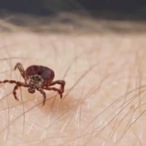 ‘My fingers were purple’: Tick-borne disease nearly killed a Canadian man