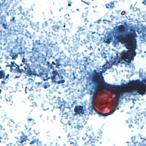 As cyclospora illnesses in U.S. surge to new record, Michigan officials eye lettuce as possible cause