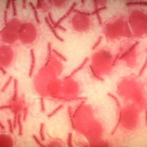 AI can fuel biological weapons. We must harness its power for defense