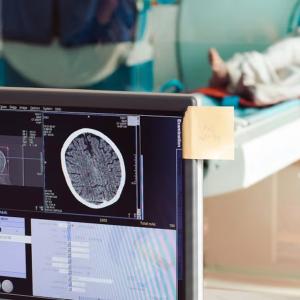 Albertans can pay for MRIs and other tests without a doctor's referral, as of Friday
